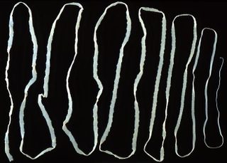 Illustration for article titled How to Kill a Parasitic Worm Living Inside of You